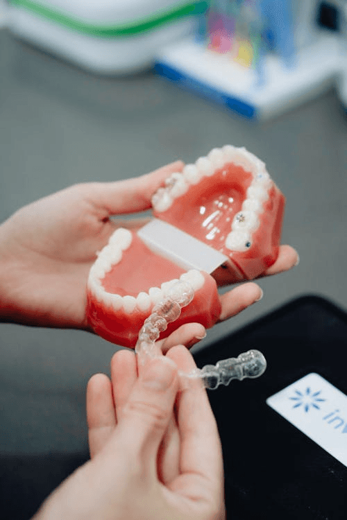 Clear Aligners vs Clips
