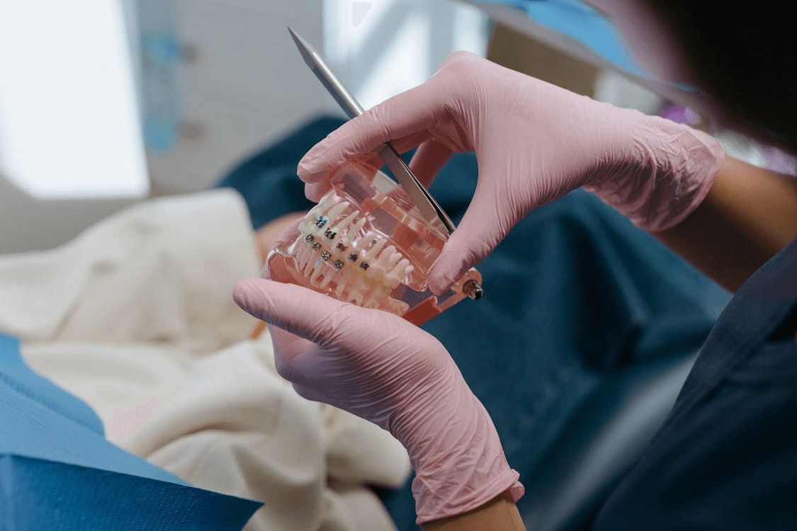 Braces Treatment in Srikakulam: What to Expect