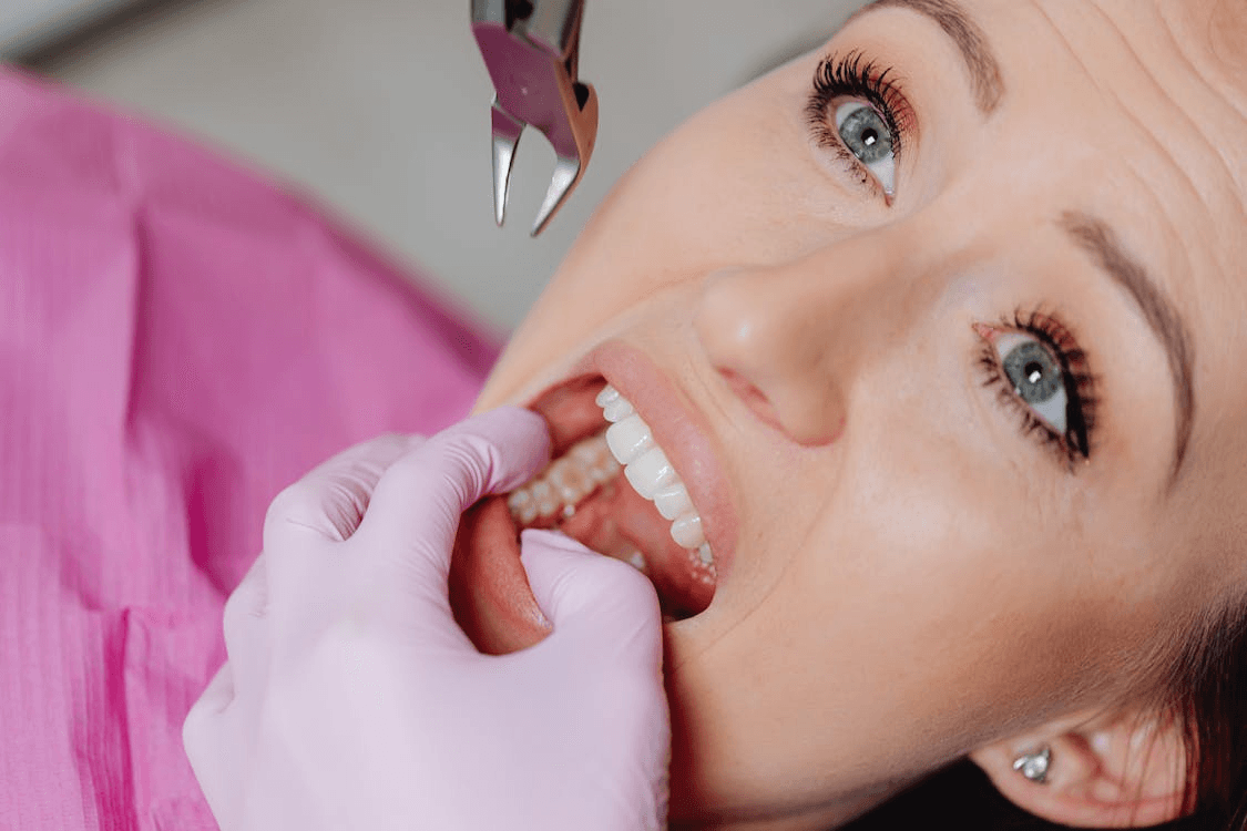 Non-Extraction Orthodontic Treatment