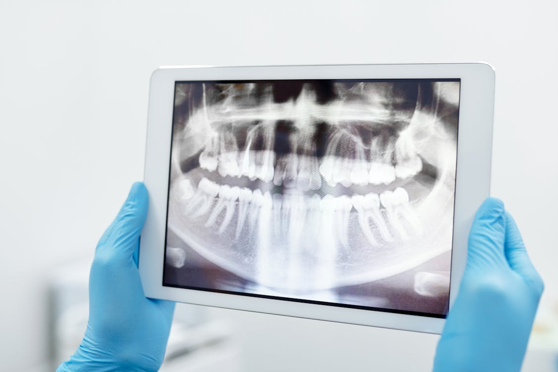 Facial Fracture Surgery