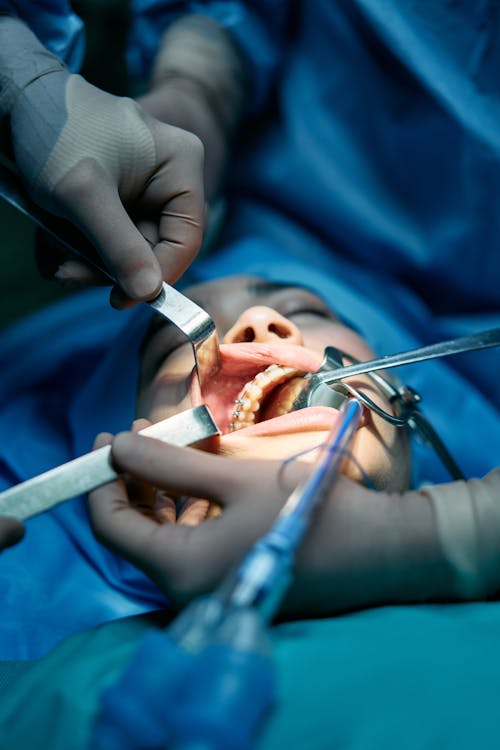 Flap Surgery